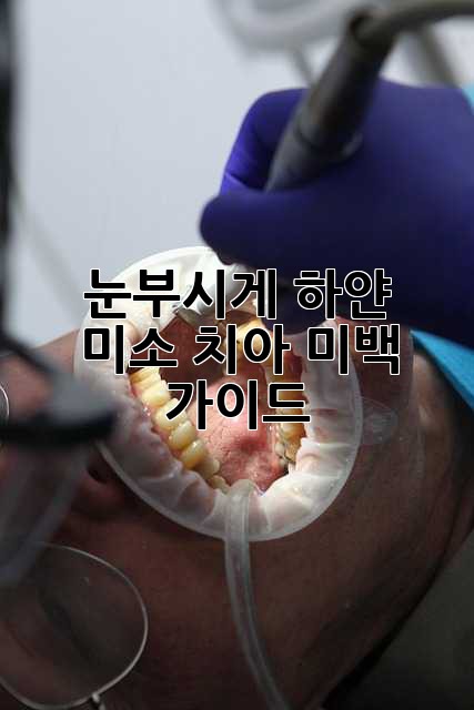 눈부시게 하얀 미소, 치아 미백 가이드